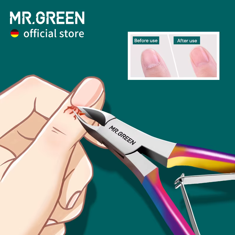 MR.GREEN-Coupe-ongles coloré, ciseaux de manucure, tondeuse, dissolvant de peau de fréquence, acier 
