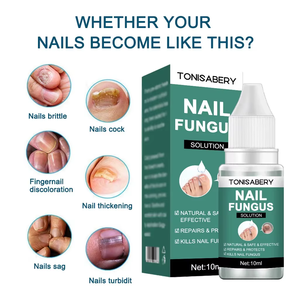 Sérum de traitement des champignons des ongles, liquide de réparation des pieds, Gel d'élimination d