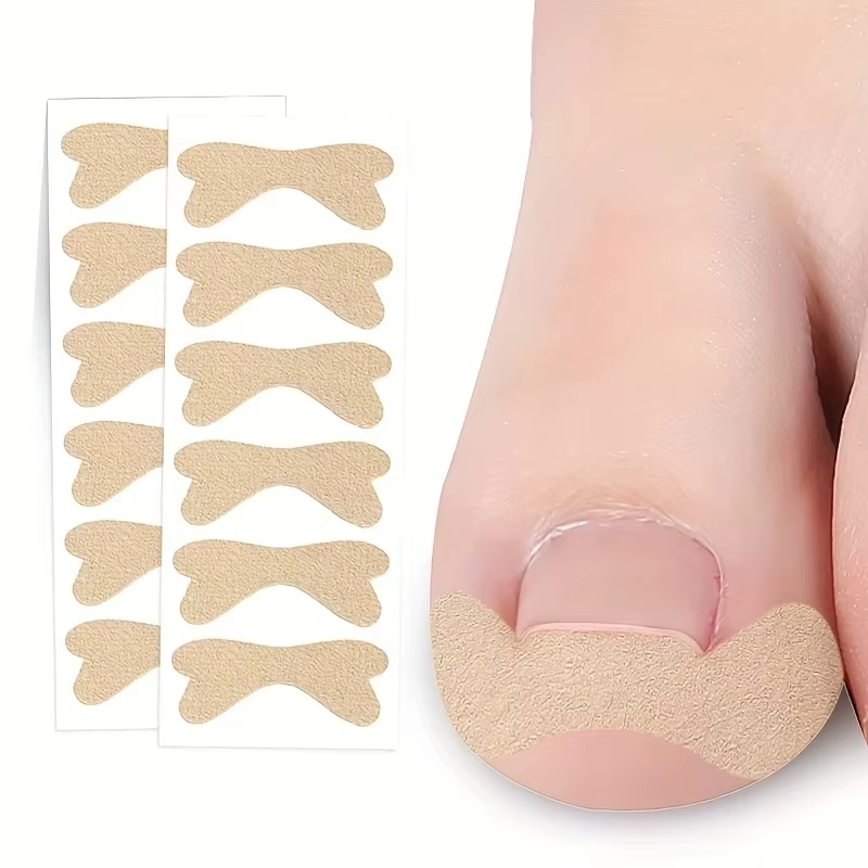 Patch Ortho pour Ongles Incarnés, Sans Colle, Améliore la Réparation des Ongles