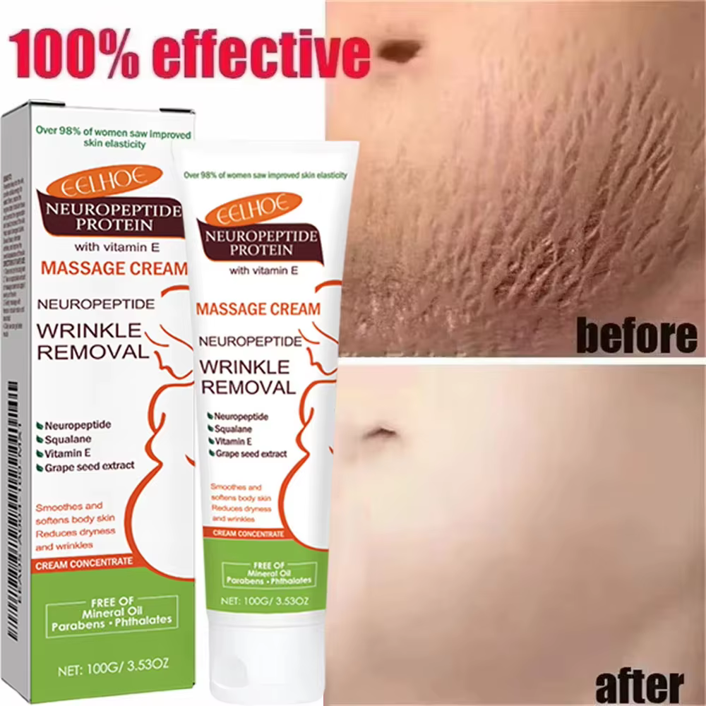 Crème anti-vergetures permanente 100g pour femmes enceintes, soin corporel lissant, réparateur et ra