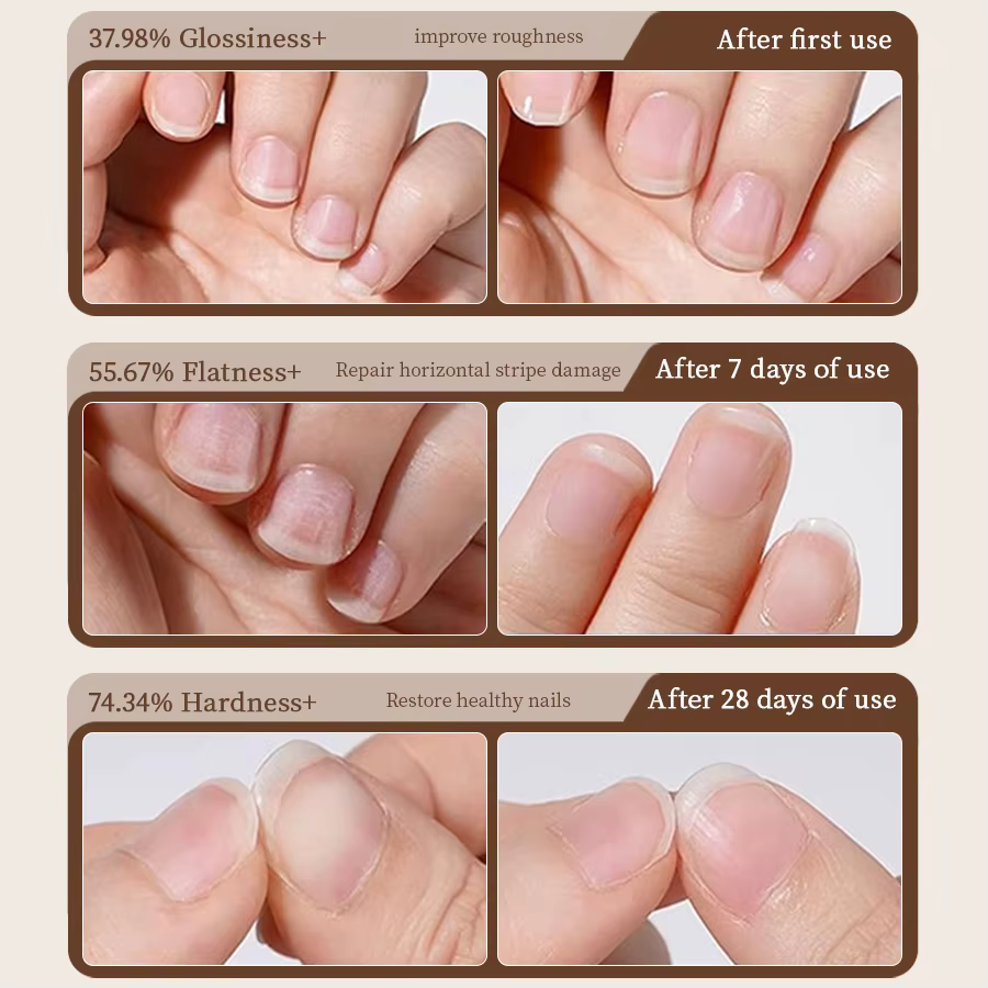 RSNAIL Stylo à huile pour cuticules 3 en 1 avec poussoir à ongles en céramique pour ongles secs et e
