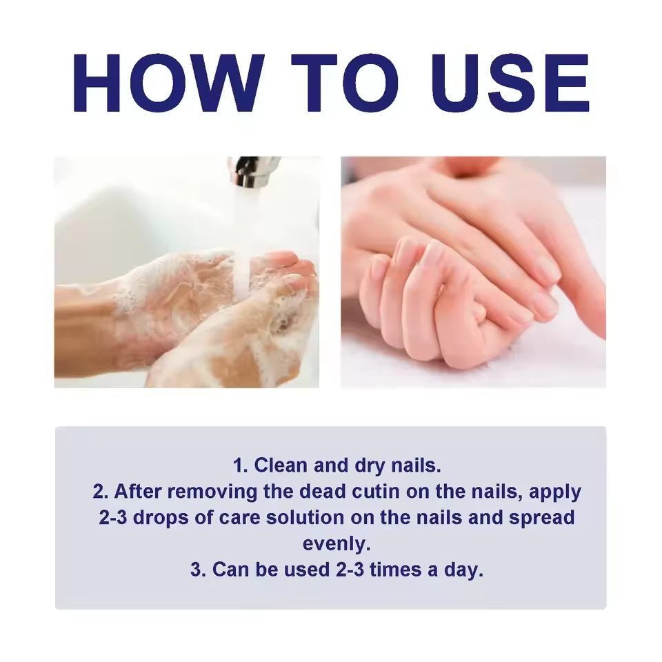 7 jours traitements fongiques des ongles sérum liquide Anti-Infection onychomycose Paronychia soin d