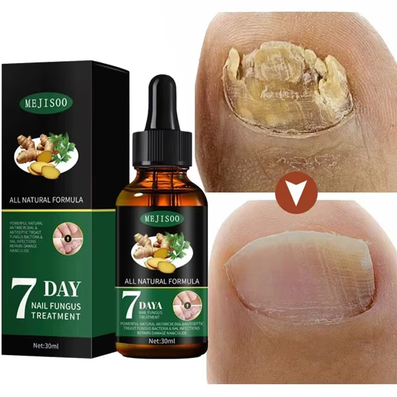 Huile de Soin des Ongles 7 Jours Formule Kératine Acides Aminés Séchage Rapide Brillance Salon Effet