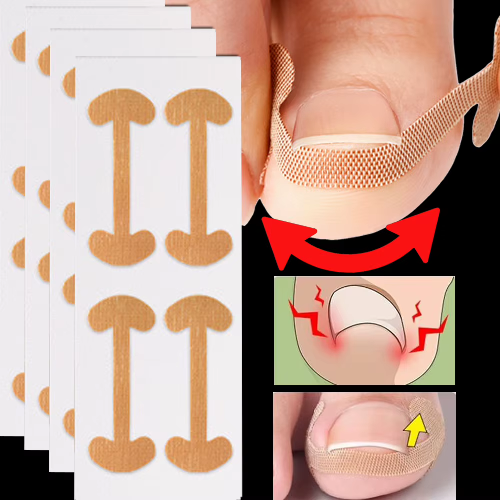 Bandes correctrices pour ongles incarnés, 100 pièces, adhérence durable, autocollants imperméables,