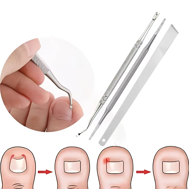 Outil de repoussage des cuticules, coupe-ongles professionnel en acier inoxydable, outil de soin des