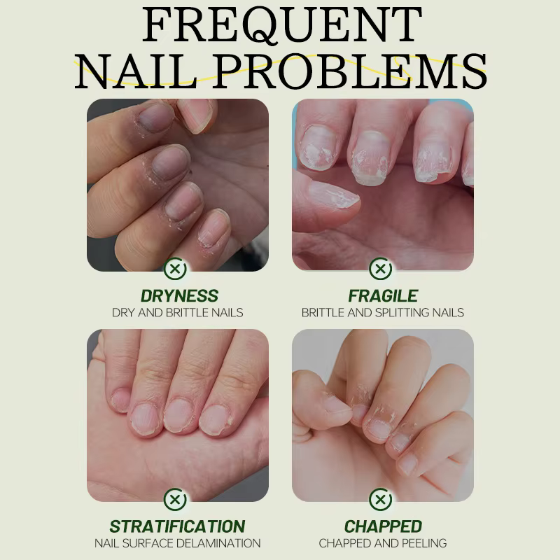 Huile de Soin des Ongles 7 Jours Formule Kératine Acides Aminés Séchage Rapide Brillance Salon Effet 90s Sans Écaillage Hydratation Profonde Renforceur d'Ongles Nouveau Produit