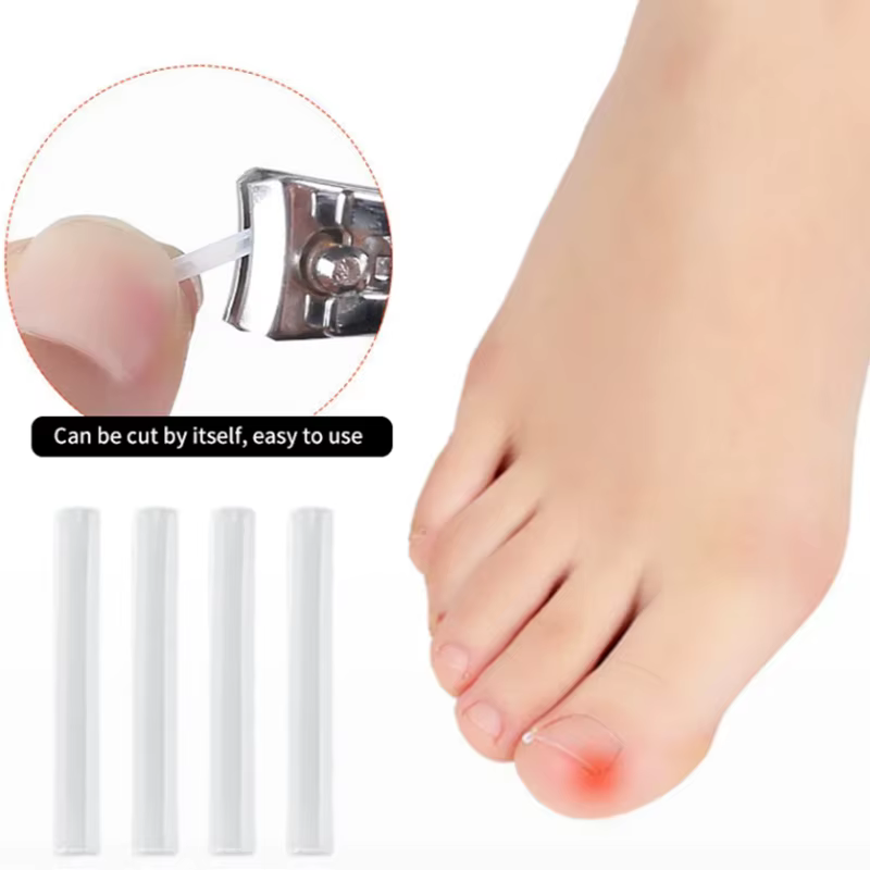 Outil de Correction des ongles incarnés