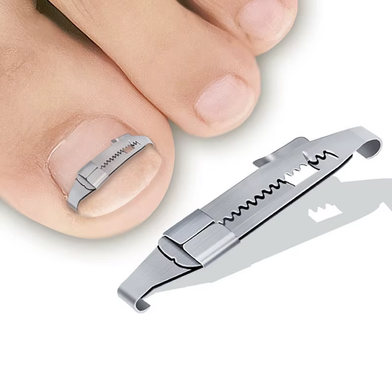 Outil professionnel de traitement des ongles incarnés
