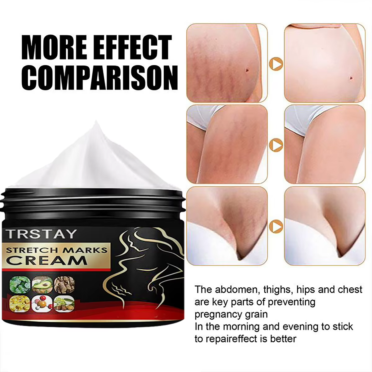 TRSTAY crème contre les vergetures pour la peau de grossesse reconstituer et réparer la Promotion de la croissance cellulaire soins de maternité Striae Gravidarum
