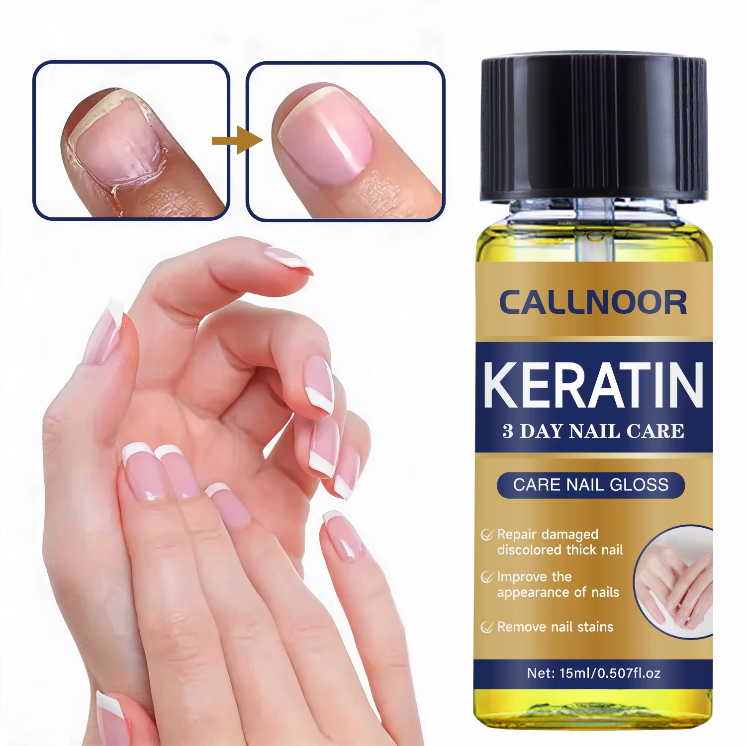 Huile à ongles à la kératine riche en plantes, renforce les ongles abîmés, adoucit et hydrate les cuticules, prévient les fissures pour le soin des ongles