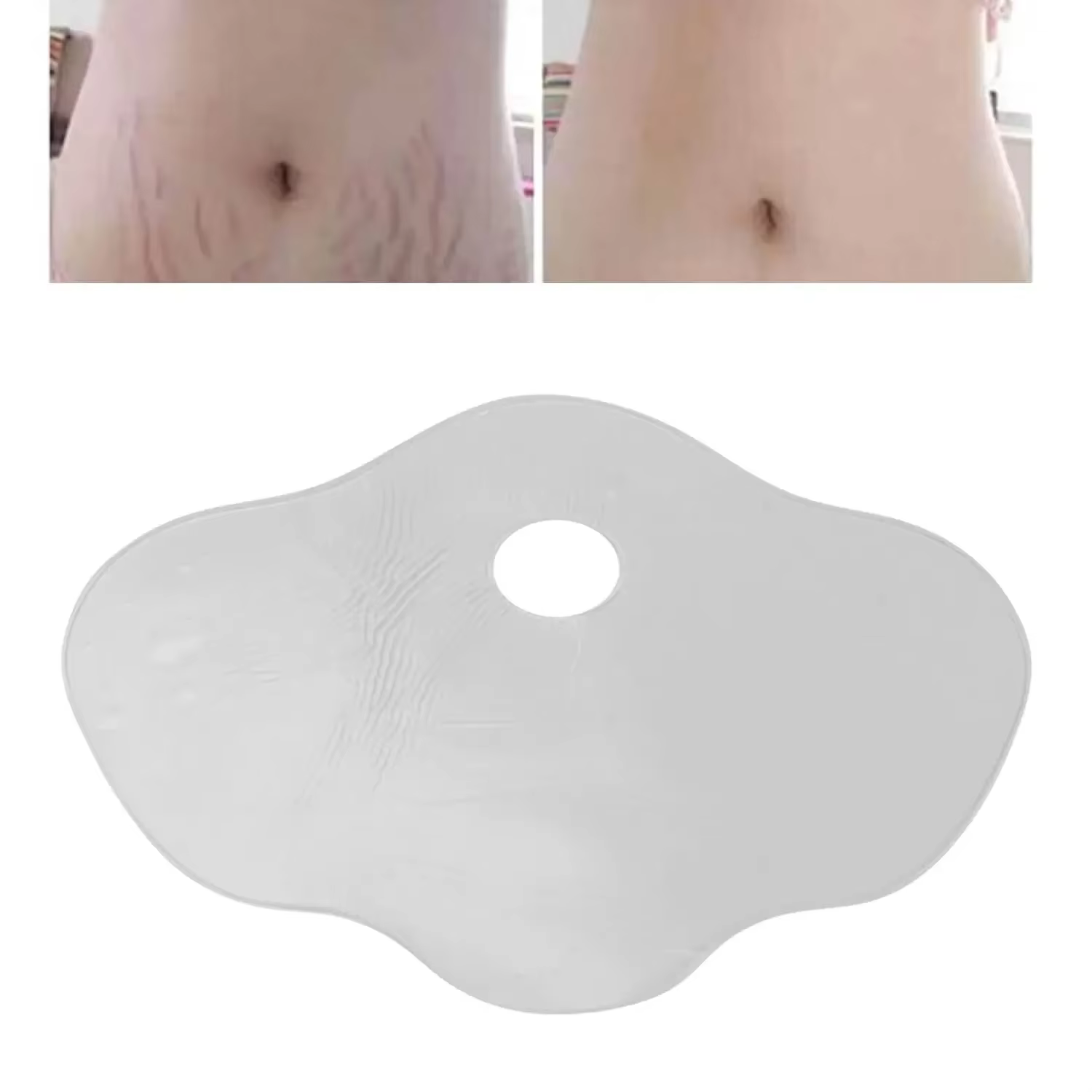 Coussin en Silicone pour le ventre, Anti-rides, cicatrices, vergetures, feuilles d'élimination réutilisables pour femmes, tampons autocollants pour l'abdomen, le ventre et l'estomac