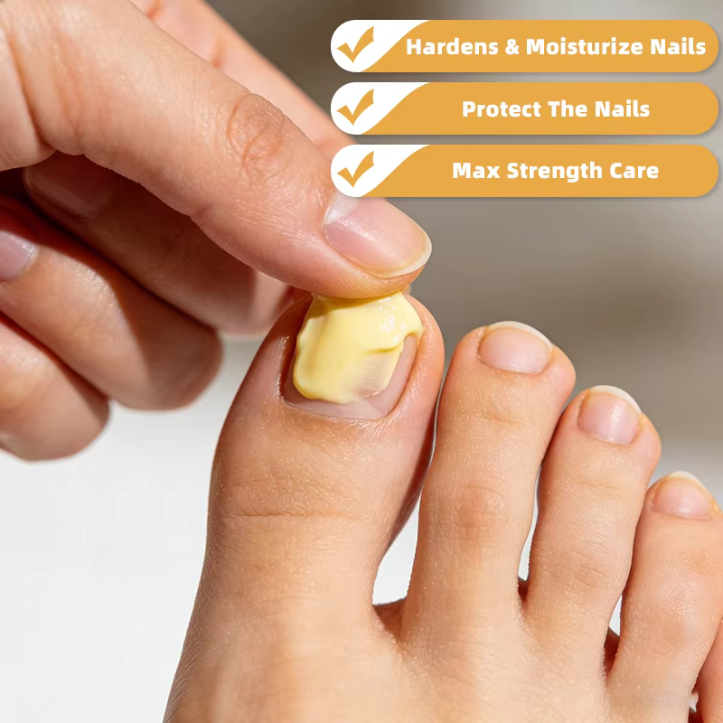 Crème de soin des ongles au venin d'abeille YUITIKUE - Protection maximale