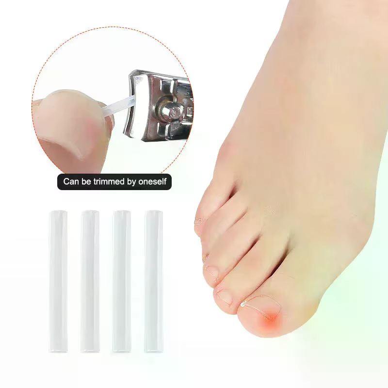 Ensemble d'autocollants correcteurs professionnels pour les ongles des pieds