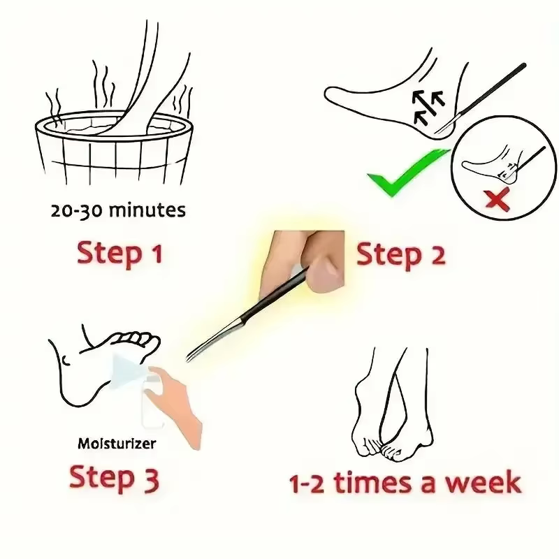 Couteau de pédicure professionnel spécial outil de pédicure des ongles maison une pièce soins de la peau outil des pieds beauté et santé