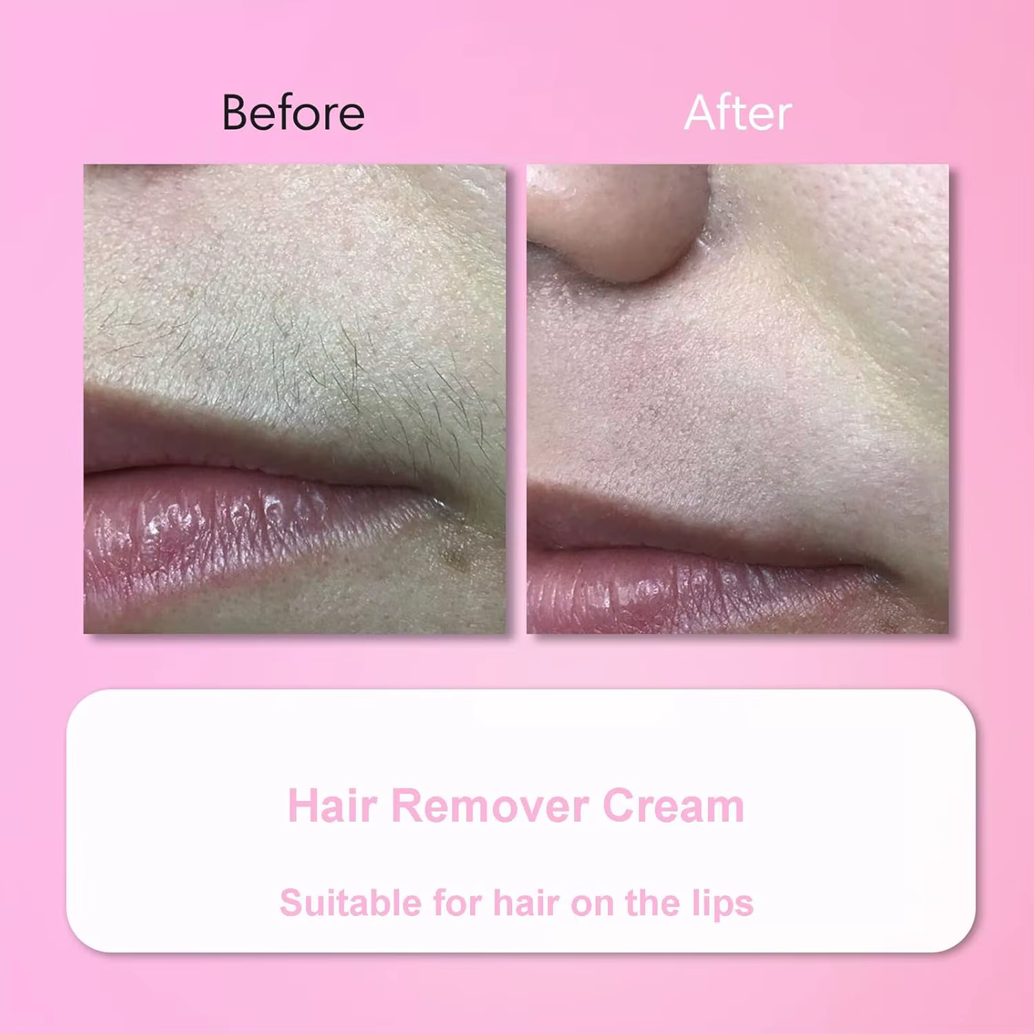 Kit de crème dépilatoire pour le visage pour femmes, pour les poils épais, fins et rebelles sur le menton, la lèvre supérieure, les pattes, crème dépilatoire douce