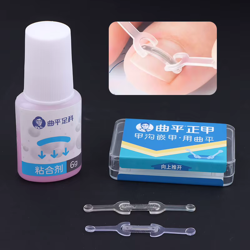 Soins des ongles, Correction des ongles incarnés
