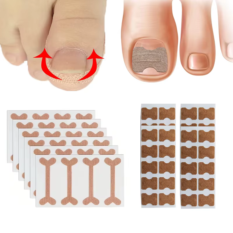 Autocollants de Correction des ongles incarnés