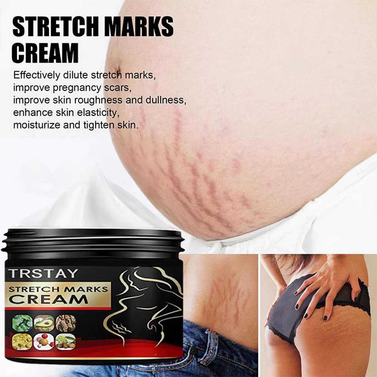 TRSTAY crème contre les vergetures pour la peau de grossesse reconstituer et réparer la Promotion de la croissance cellulaire soins de maternité Striae Gravidarum