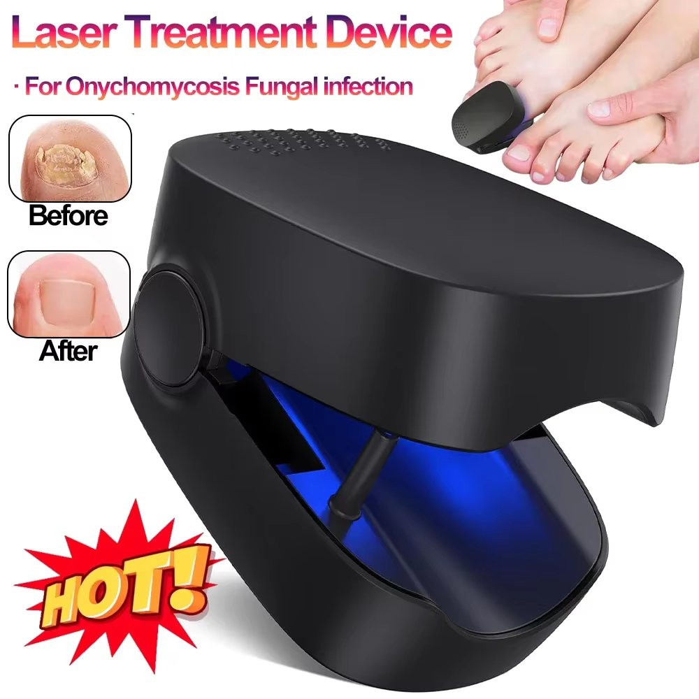 Appareil laser LED pour le traitement des mycoses des ongles