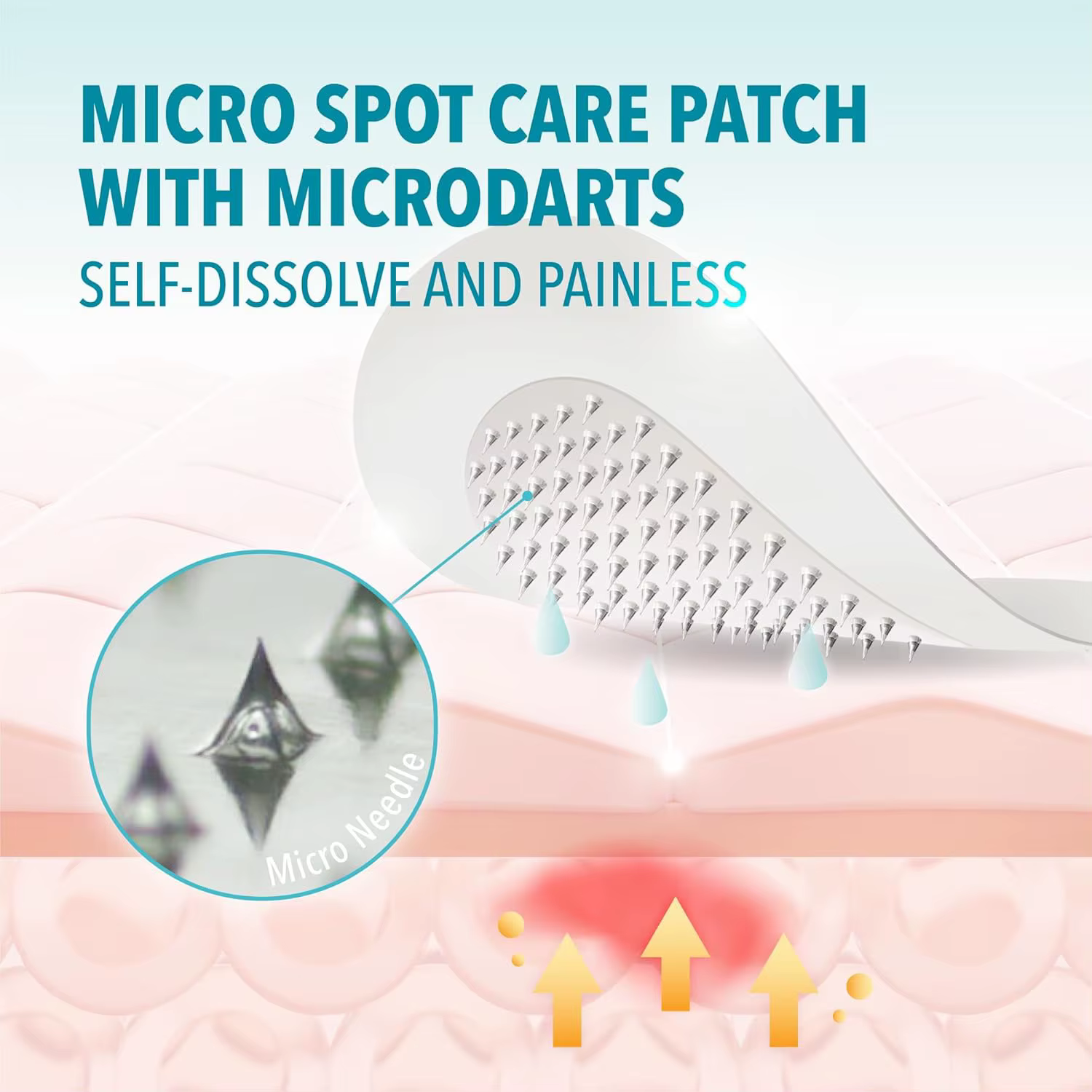 Ensemble de 4 patchs de soin corporel à micro-aiguilles nano, conçus pour un nettoyage complet, sans laisser de résidus, résistants à l'eau et à la transpiration.