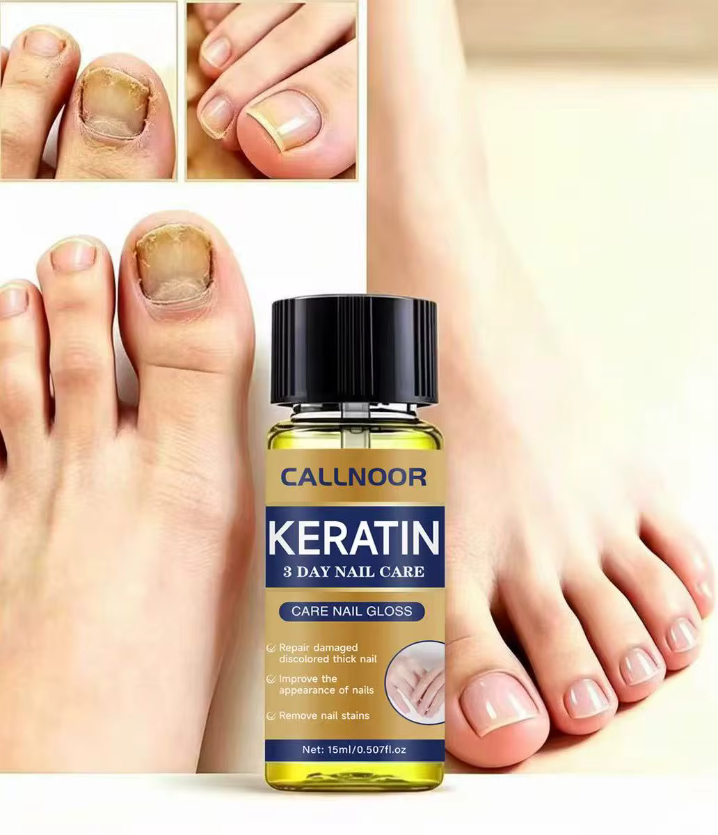 Huile à ongles à la kératine riche en plantes, renforce les ongles abîmés, adoucit et hydrate les cuticules, prévient les fissures pour le soin des ongles