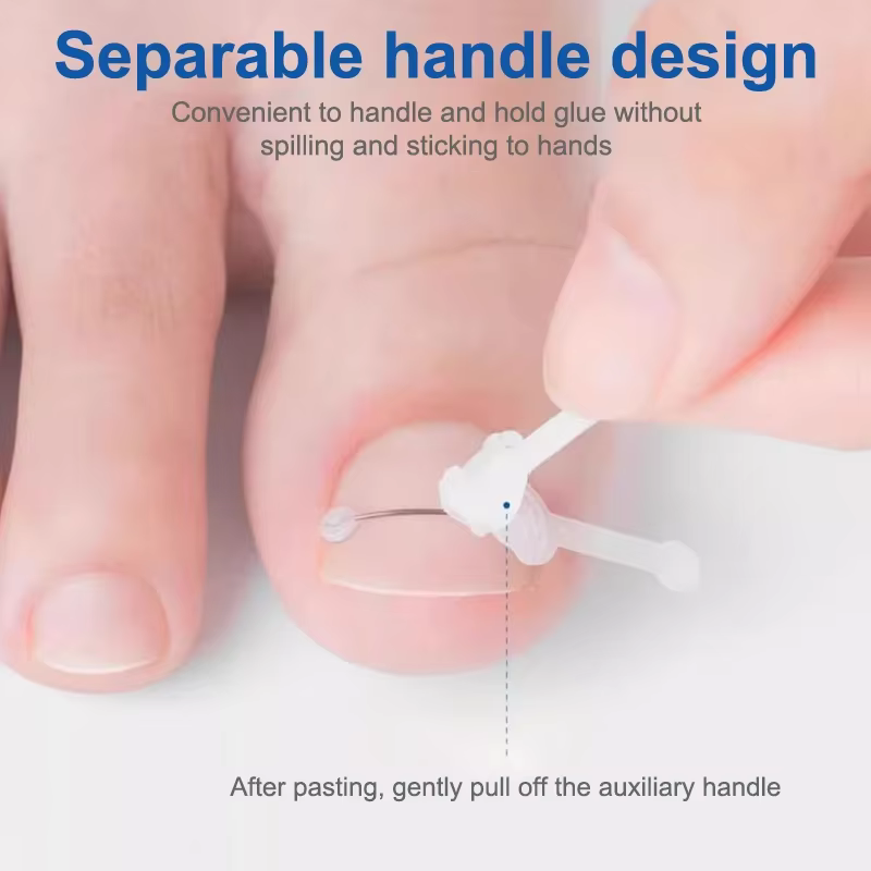 Soins des ongles outil de Correction