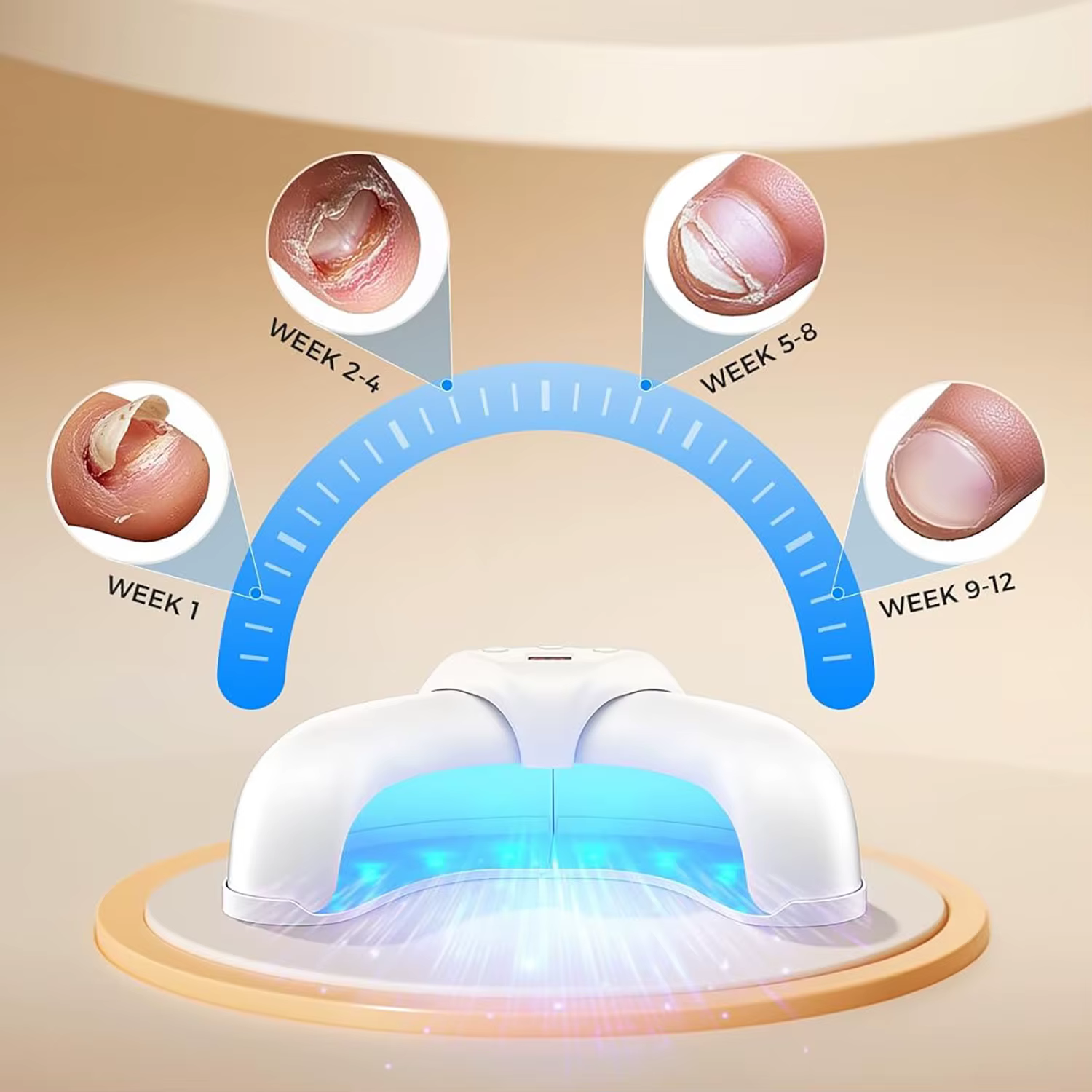 Dispositif Laser fongique pour réparation des ongles des pieds