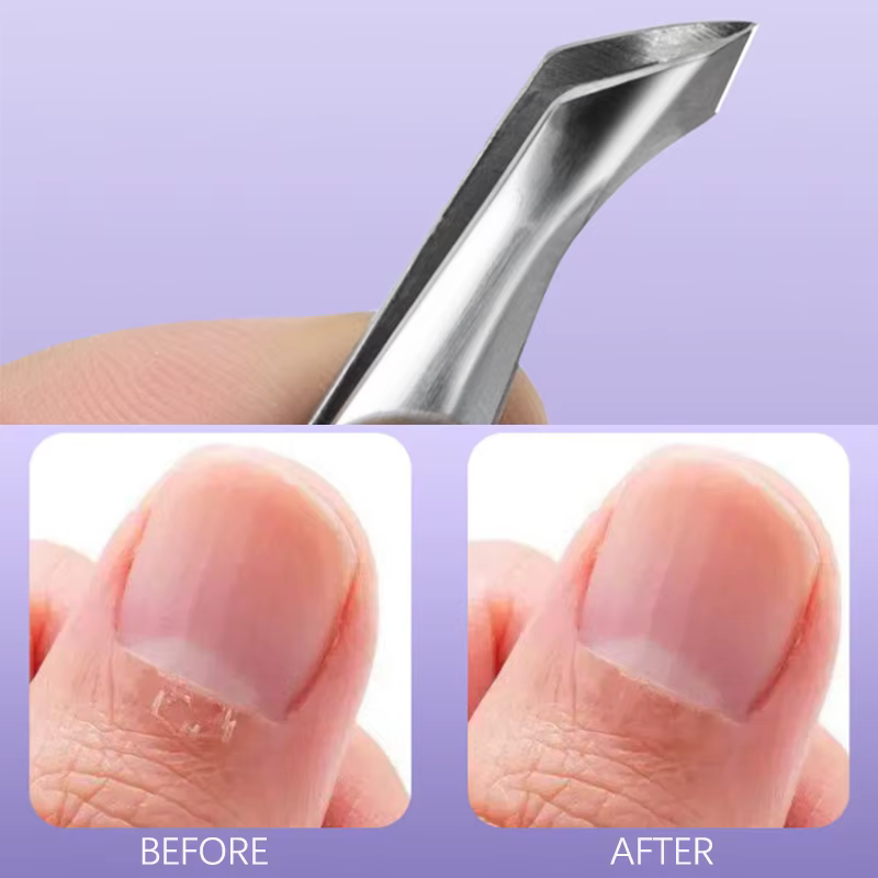 ❤️ Pince à cuticules et à ongles incarnés Hangnail Squeeze And Snip pour éliminer la peau morte